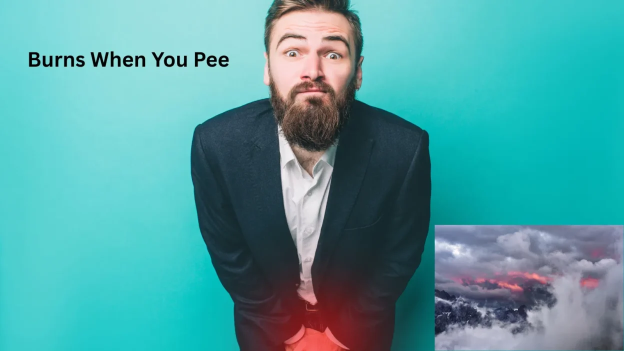 Burns When You Pee