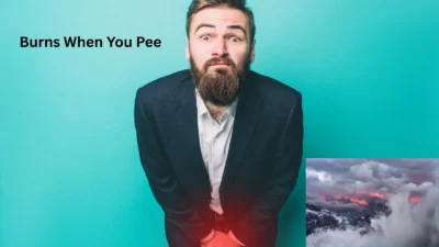 Burns When You Pee